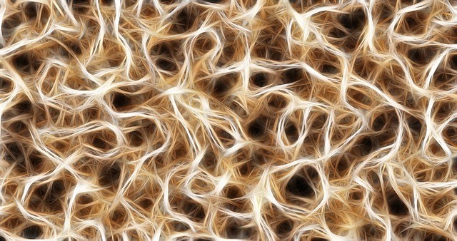Takhle nějak si můžeme představit dendrity...