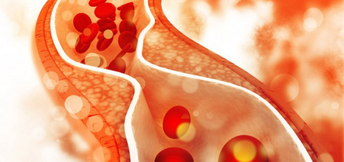 Doporučený maximální příjem cholesterolu u nesportující populace by neměl překračovat 300 mg denně (například 1,5 vejce)