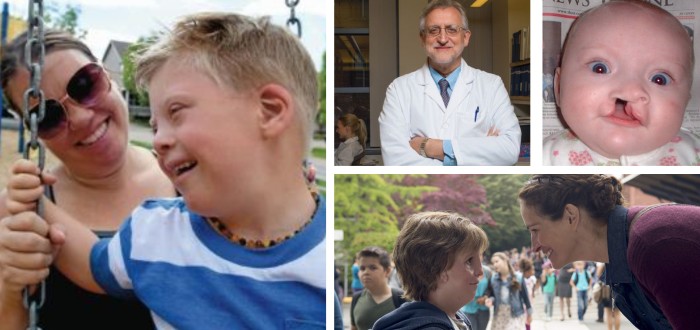 TC syndrom je autozomálně dědičné onemocnění postihující obě pohlaví