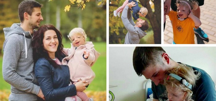 S Treacher Collins syndromem se potýká i malá Beatka