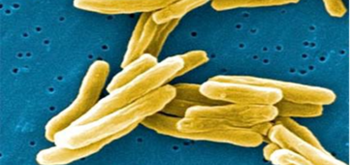 Mycobacterium tuberculosis – původce TBC v elektronovém mikroskopu
