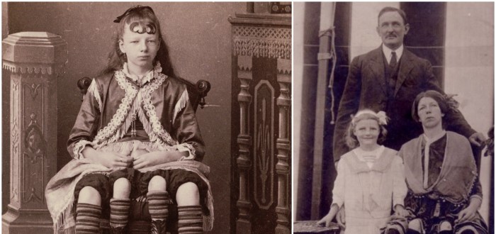Myrtle Corbinová neměla jednoduchý život, ale nevzdala se. I jako čtyřnohá vedla poměrně normální život