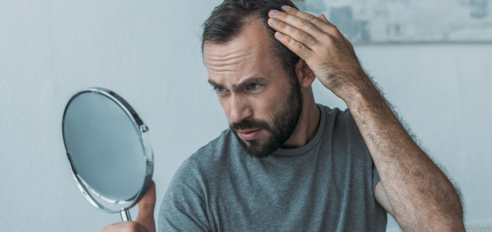 Mezi rizikové faktory vzniku alopecie patří mimo jiné obyčejný stres
