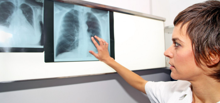 Test se provádí z krve a je možné jej podstoupit u lékařů nejrůznějších specializací, například u pneumologa, praktika či alergologa