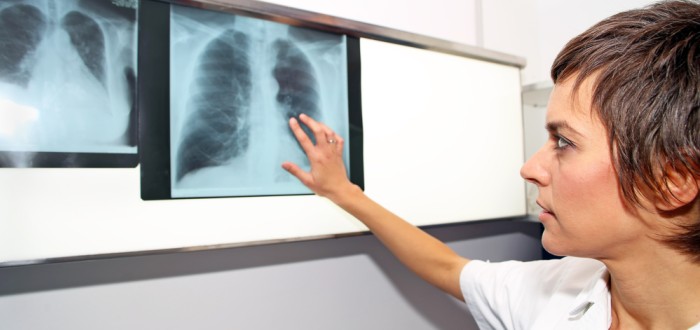Test se provádí z krve a je možné jej podstoupit u lékařů nejrůznějších specializací, například u pneumologa, praktika či alergologa