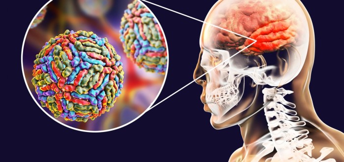 K rozvoji závažnějších symptomů západonilské horečky jsou mnohem náchylnější lidé s oslabeným imunitním systémem
