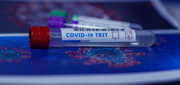 Nový test je prozatím povolený v USA a lidem přinese výsledky do půl hodiny