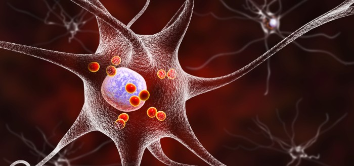Za parkinsona může zásadní ztráta nervových buněk produkujících v mozku neurotransmiter dopamin