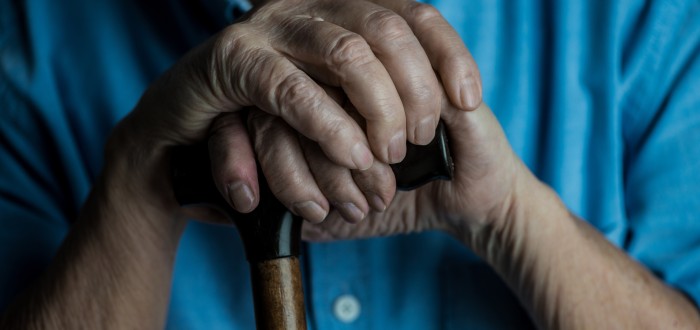 Osteoartrózu poznáte spolehlivě pomocí rozšířených částí prstů