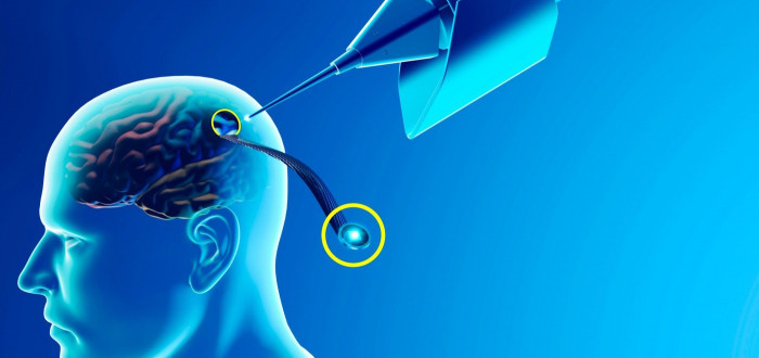 Prvotním cílem implantace čipu do mozku člověka je, aby byli lidé bez končetin schopni ovládat počítače