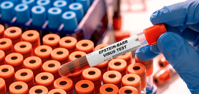 Virus Epsteina–Barrové (lidský herpesvirus 4 nebo EB virus), je virus z čeledi herpes virů