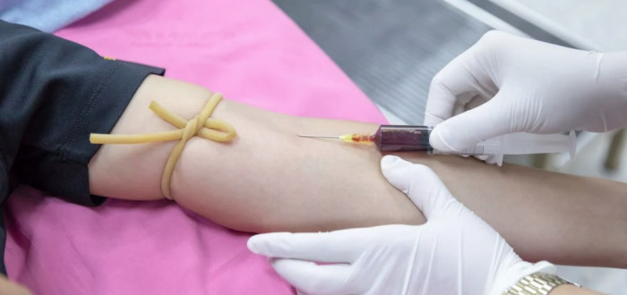 Darování krevní plasmy vyžaduje odhodlání a odvahu. Důležitou součástí krevní plasmy je albumin