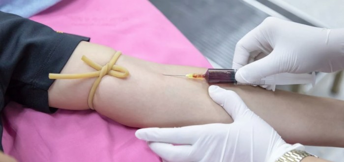 Darování krevní plasmy vyžaduje odhodlání a odvahu. Důležitou součástí krevní plasmy je albumin