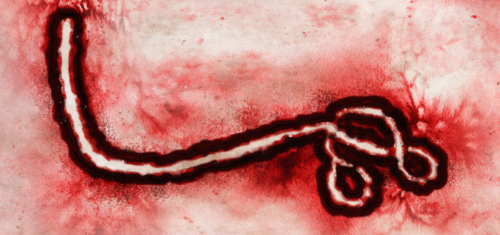 Ebola představuje jednu z nejnebezpečnějších nákaz, s jakou se kdy lidstvo setkalo. Původcem onemocnění je filovirus ebola