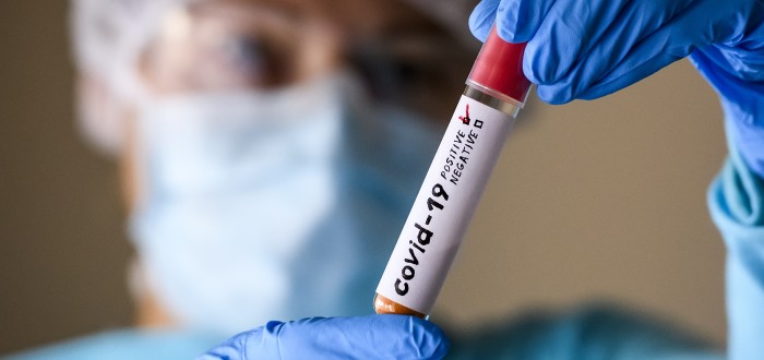Podle viroložky Hany Zelené není důvod k panice
