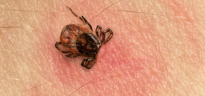 Klíšťová encefalitida je infekční virové onemocnění, které napadá nervový systém