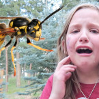 Co dělat a jak se zachovat, když dítě bodne vosa?