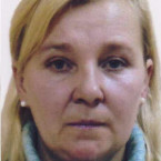 Žena má pravděpodobně nakažlivou plicní chorobu
