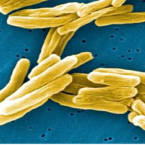 Mycobacterium tuberculosis – původce TBC v elektronovém mikroskopu