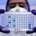 Moderní metody sekvenování DNA přináší celou řadu možností při výzkumu vývoje lidské imunity. 