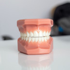 Onemocnění dásní je pro náš organismus tak nebezpečné, protože v ústní dutině způsobuje záněty, které se poté šíří po těle