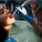 Při nejpečlivější domácí hygieně se na zubech hromadí bakteriální biofilm a pigmentace z kávy, čaje nebo červeného vína, které domácí péče nedokáže plně odstranit