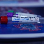 Testovat by se chtělo mnohem více lidí, než je možné