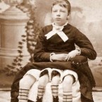 Američanka Myrtle Corbin byla hvězdou v cirkusu. 